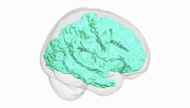 Full Brain White