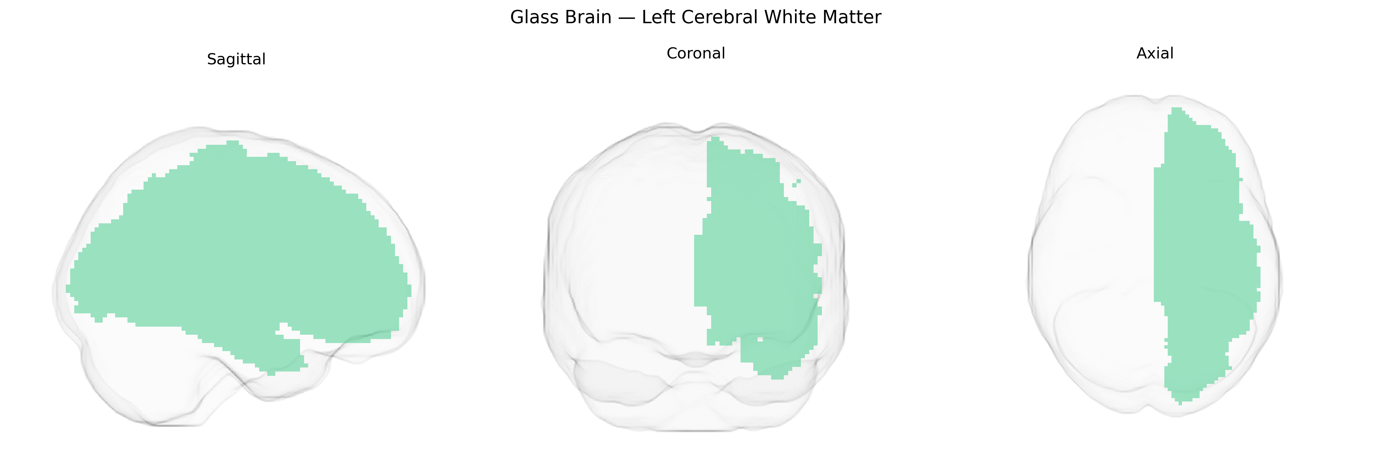 Triplanar Ghost Brain