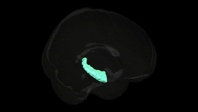 Full Brain Black