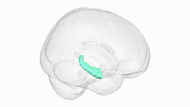 Full Brain White
