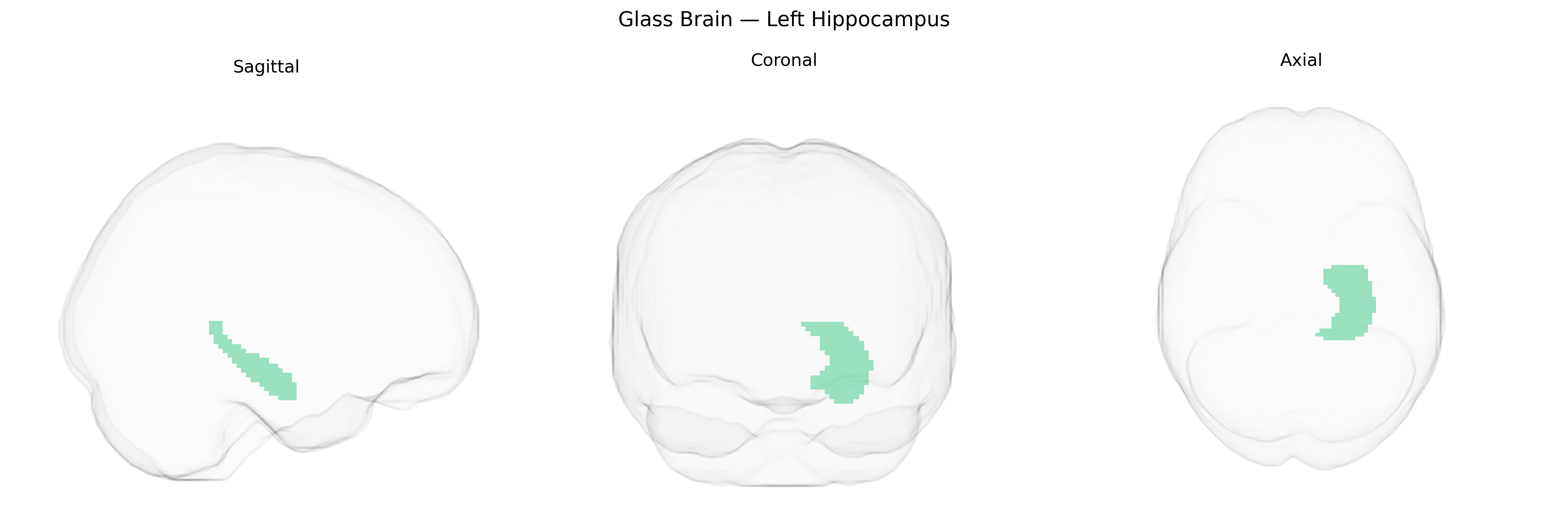 Triplanar Ghost Brain