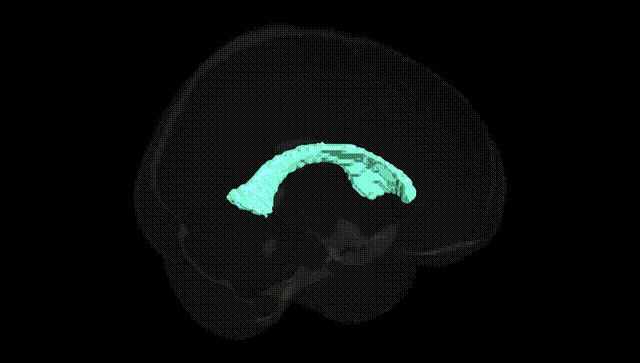 Full Brain Black