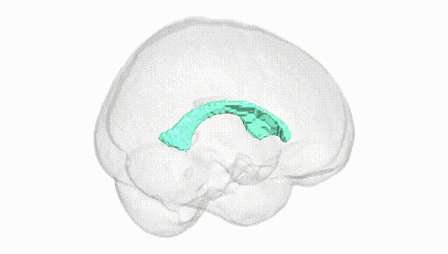 Full Brain White