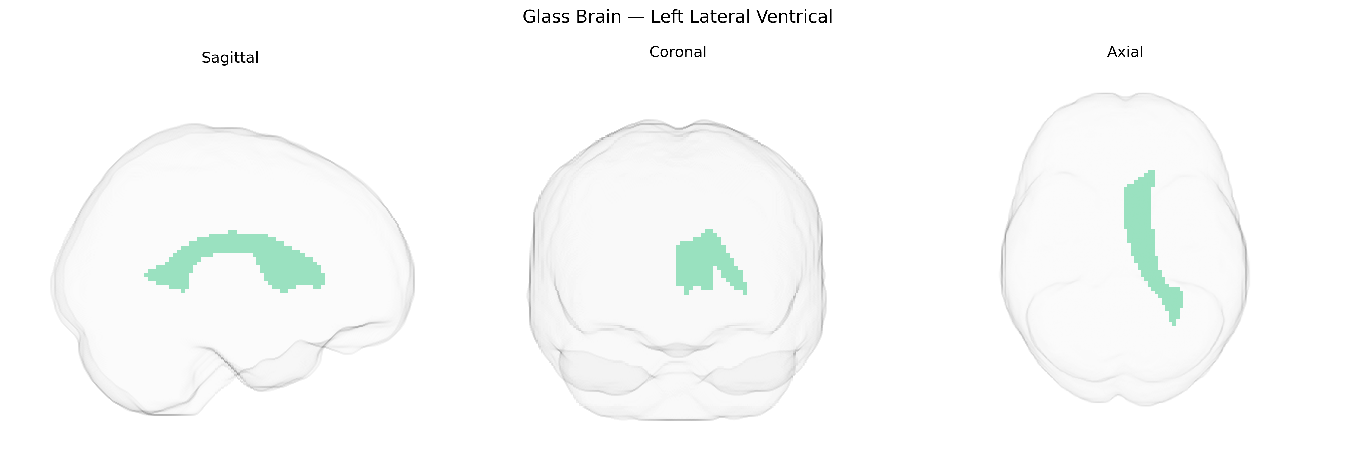 Triplanar Ghost Brain