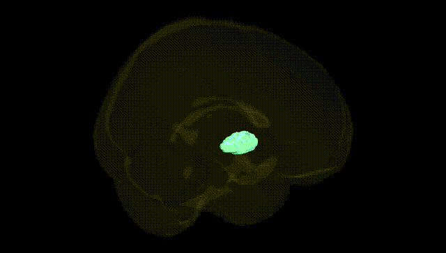 Full Brain Black