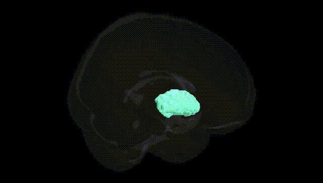 Full Brain Black