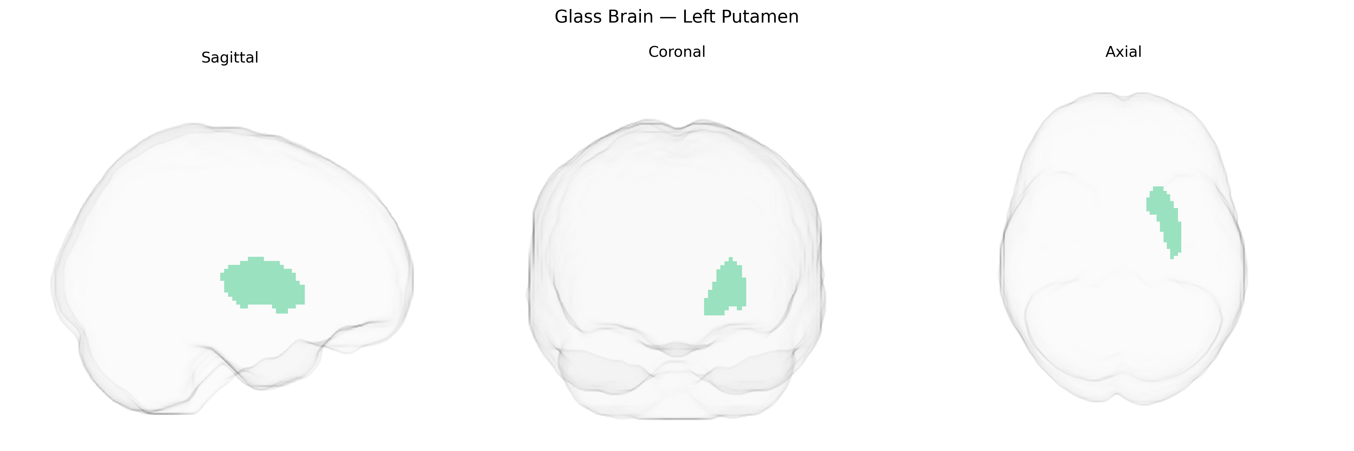 Triplanar Ghost Brain