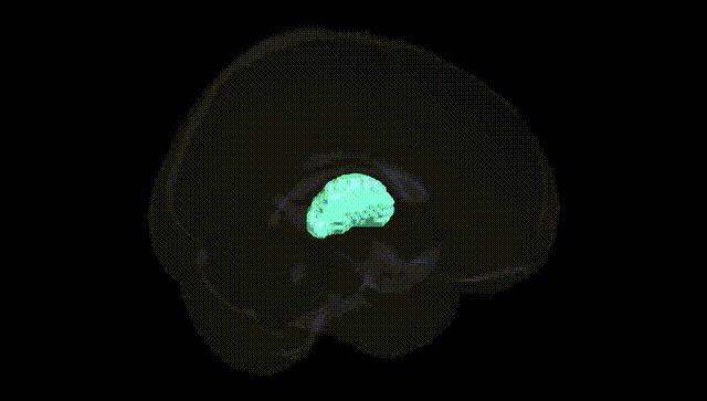 Full Brain Black