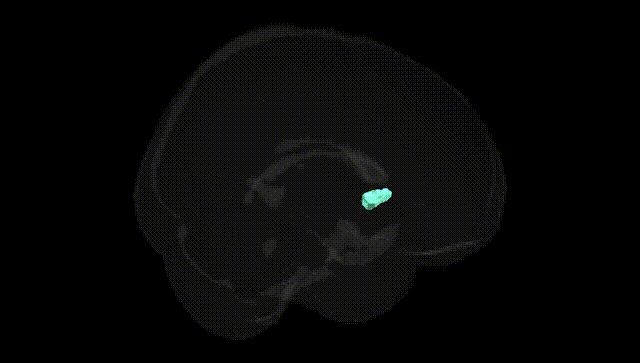 Full Brain Black