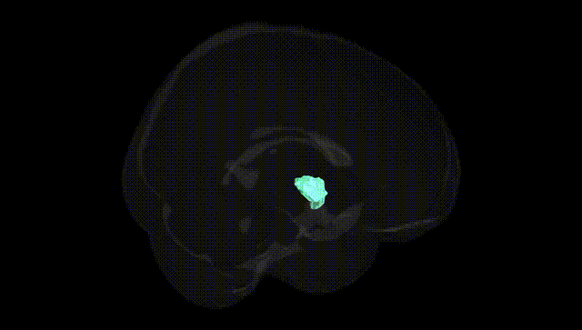 Full Brain Black