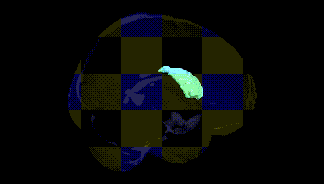Full Brain Black