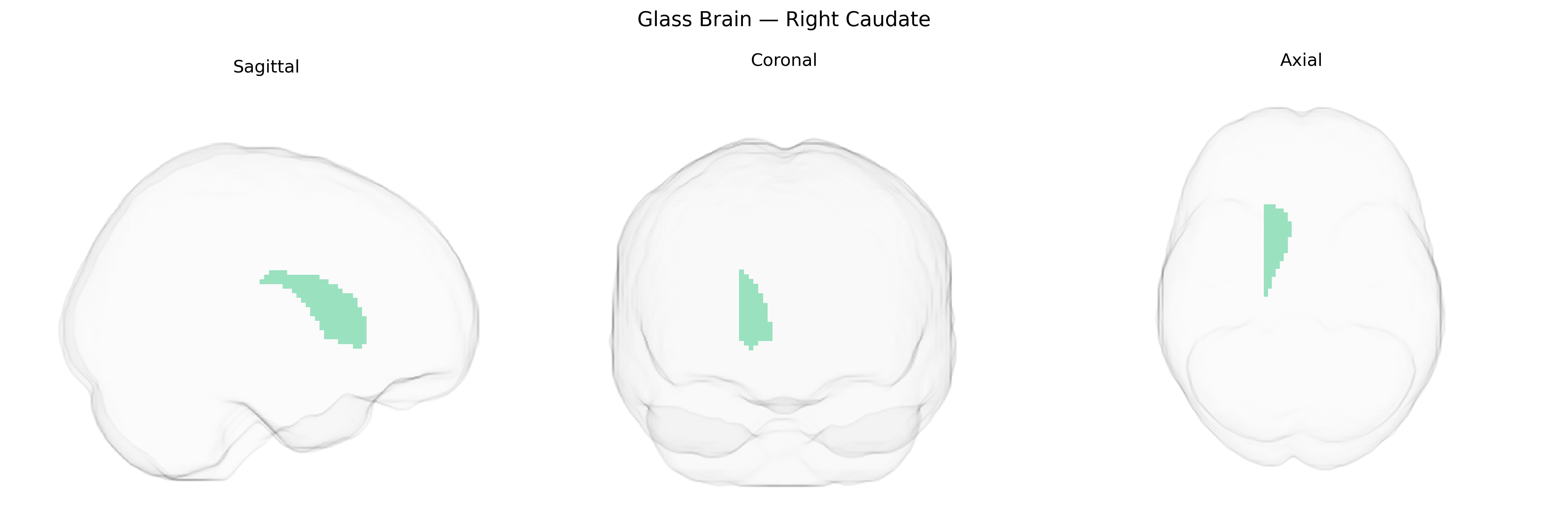 Triplanar Ghost Brain