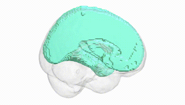 Full Brain White