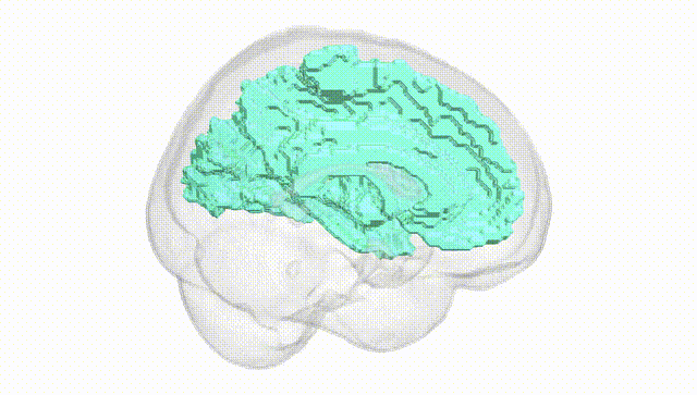Full Brain White