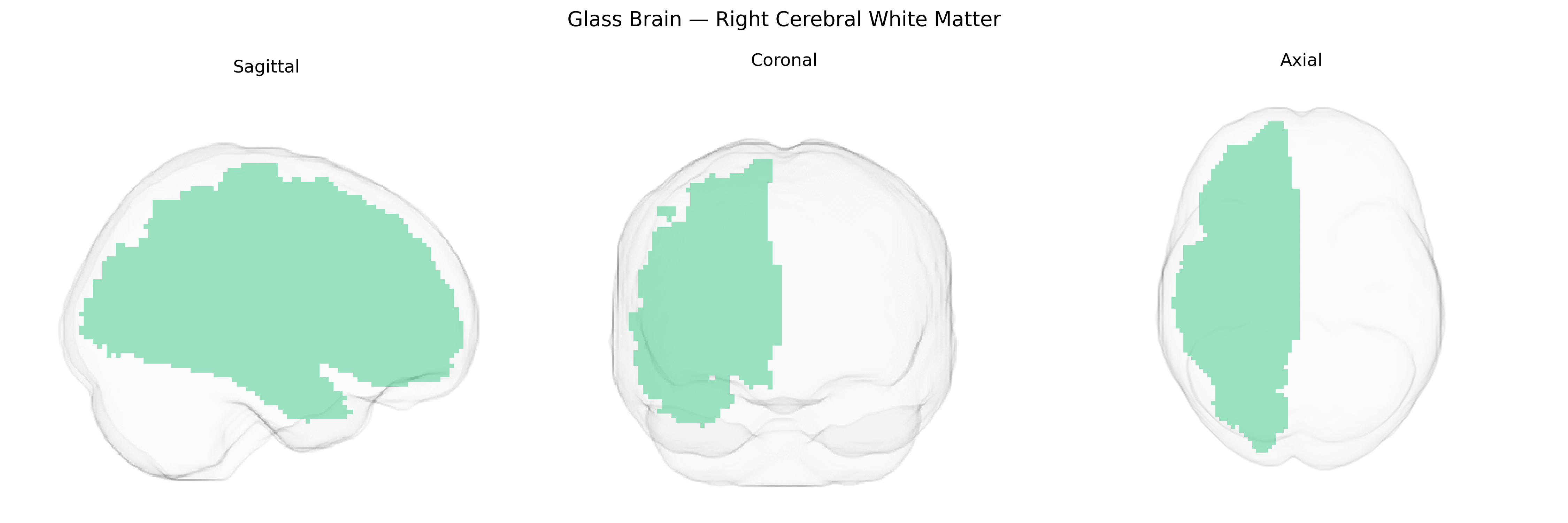 Triplanar Ghost Brain