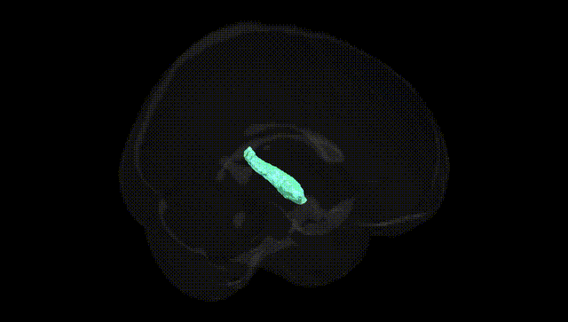 Full Brain Black