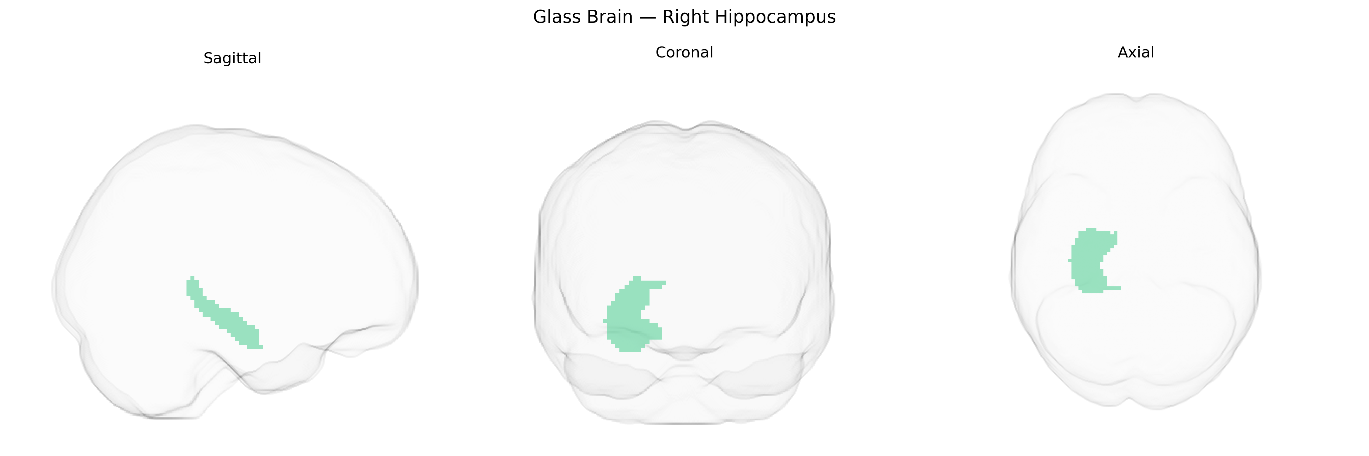 Triplanar Ghost Brain