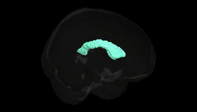 Full Brain Black