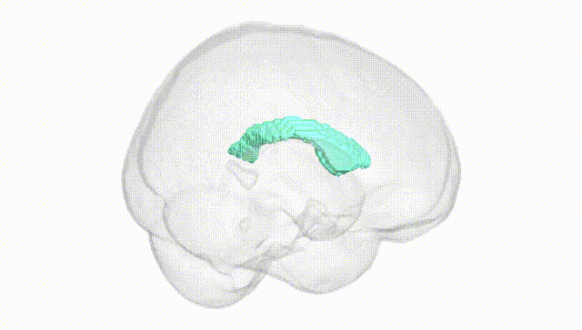 Full Brain White