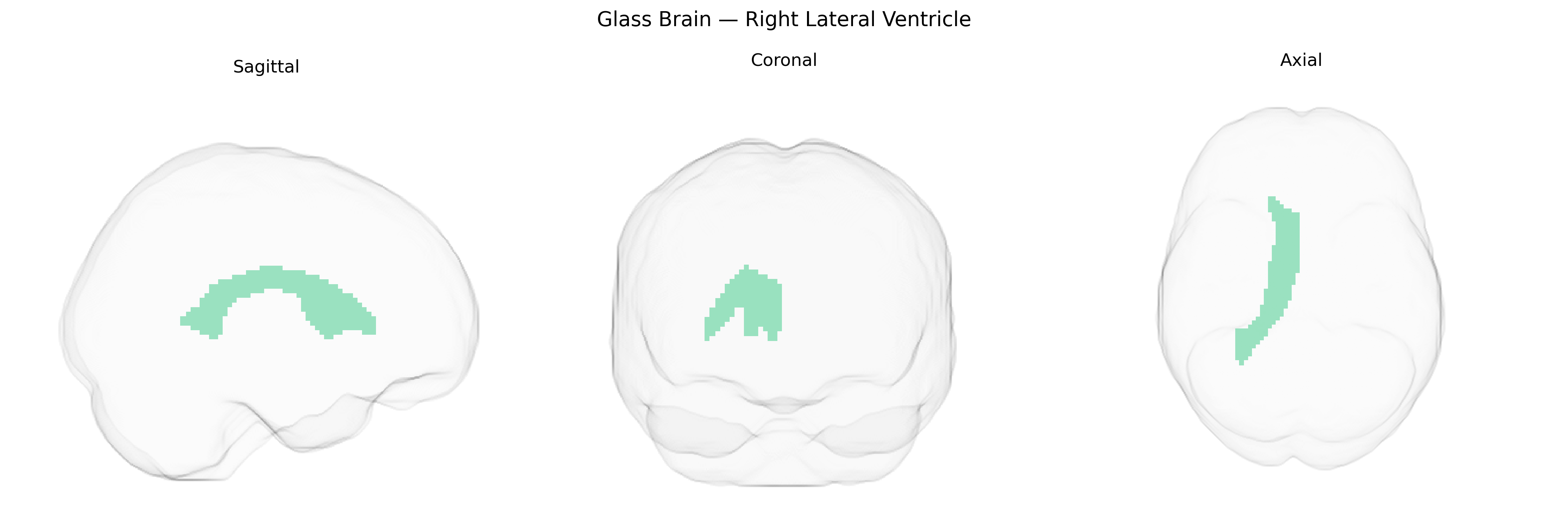 Triplanar Ghost Brain