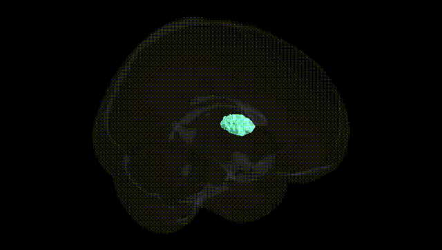 Full Brain Black
