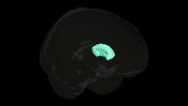Full Brain Black