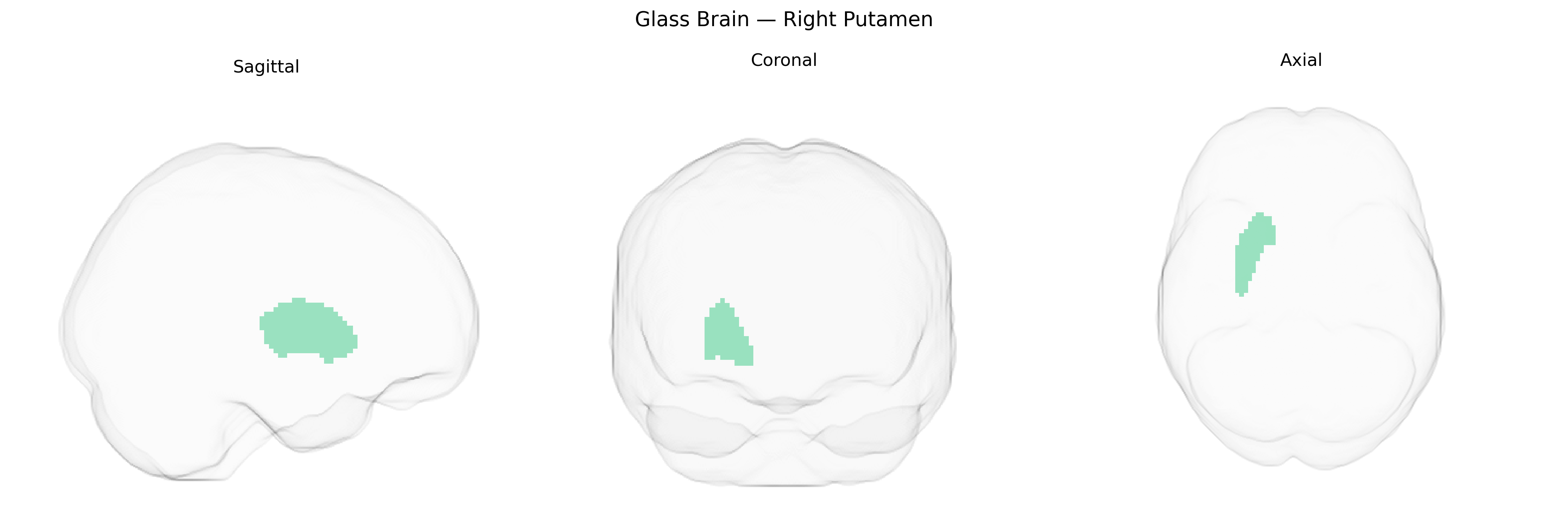 Triplanar Ghost Brain