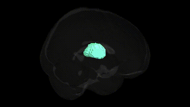 Full Brain Black