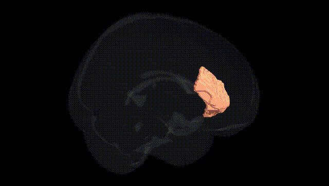 Full Brain Black