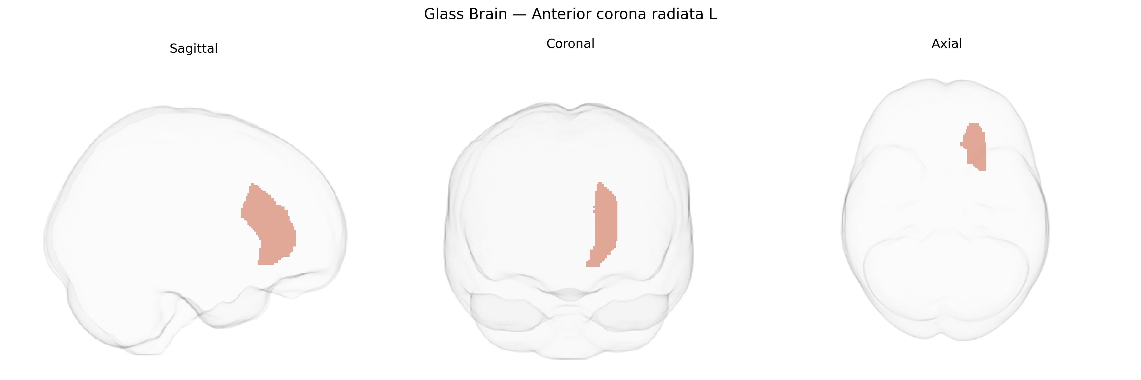 Triplanar Ghost Brain