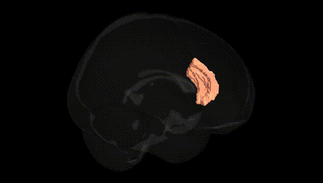 Full Brain Black