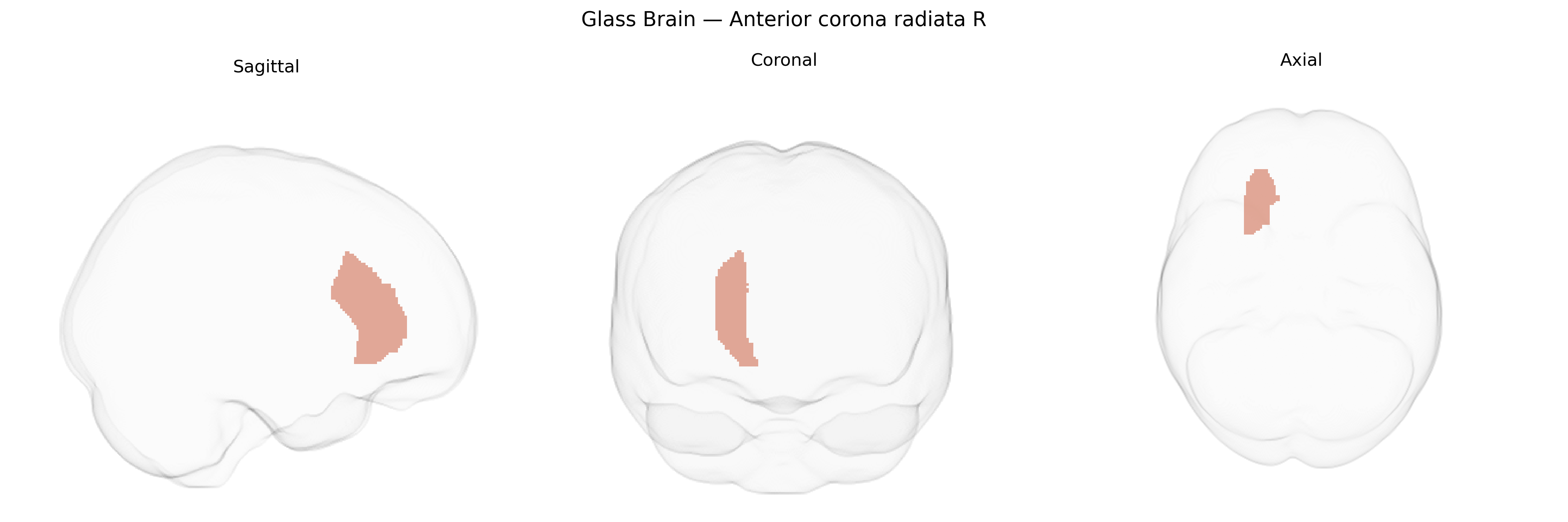 Triplanar Ghost Brain