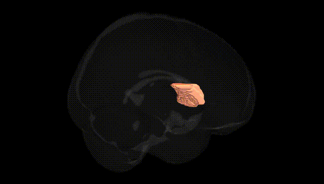 Full Brain Black