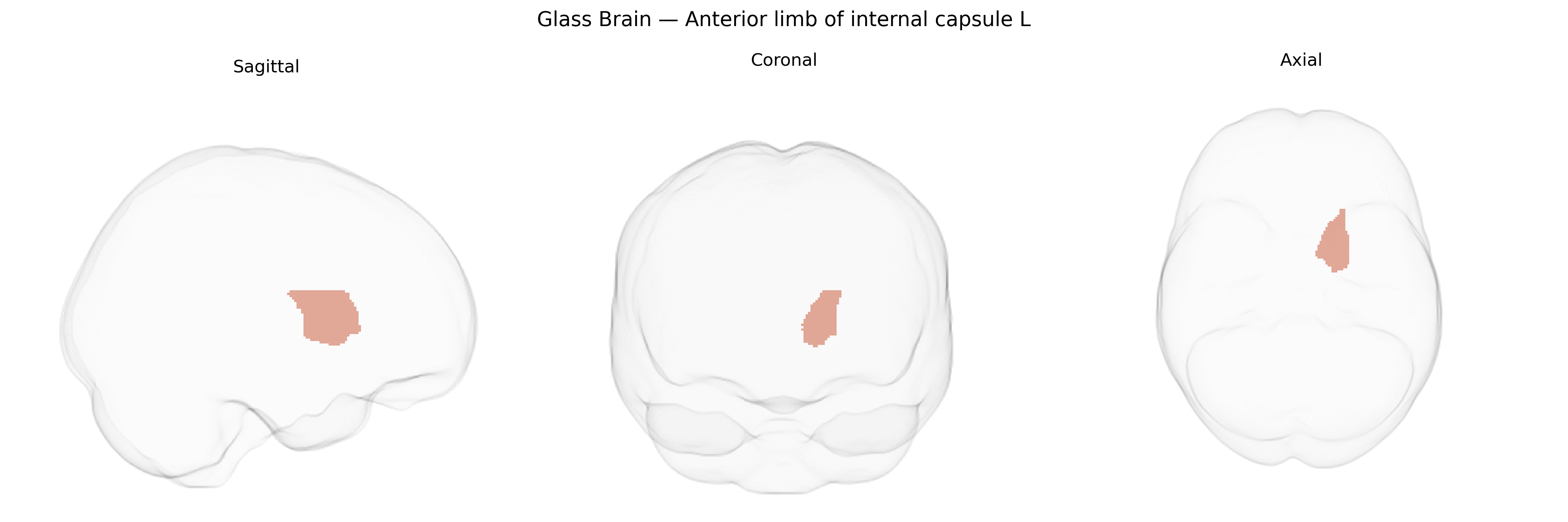 Triplanar Ghost Brain