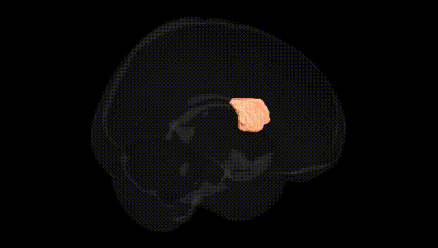 Full Brain Black