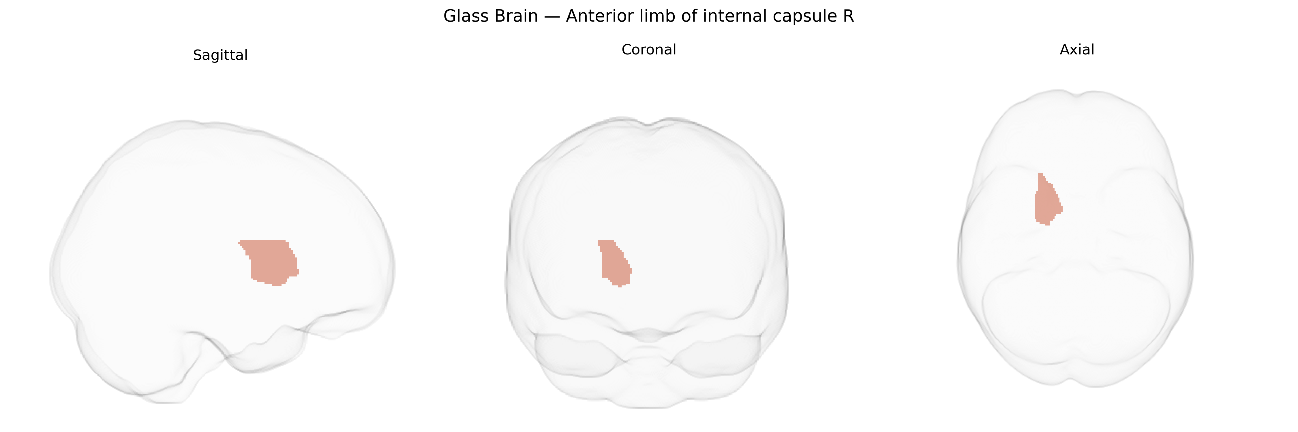 Triplanar Ghost Brain
