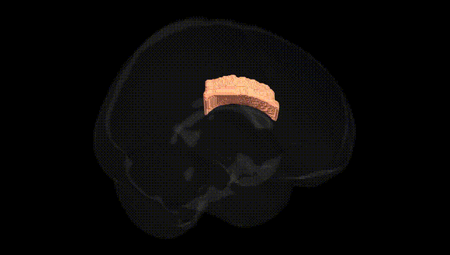 Full Brain Black