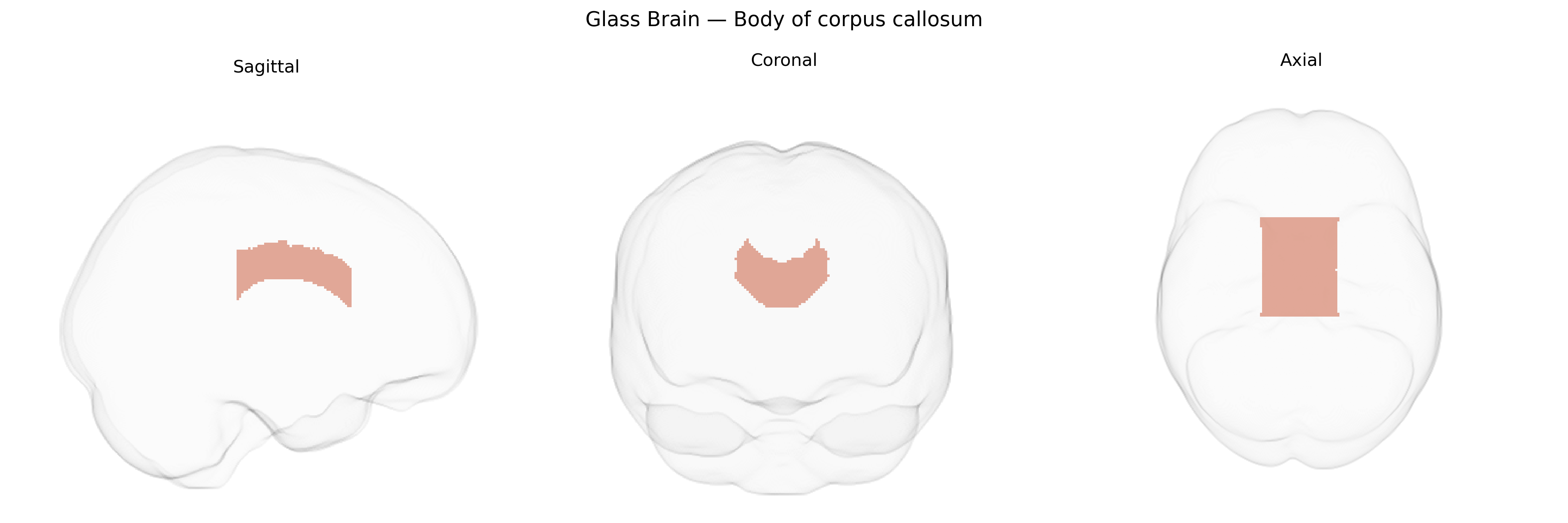 Triplanar Ghost Brain