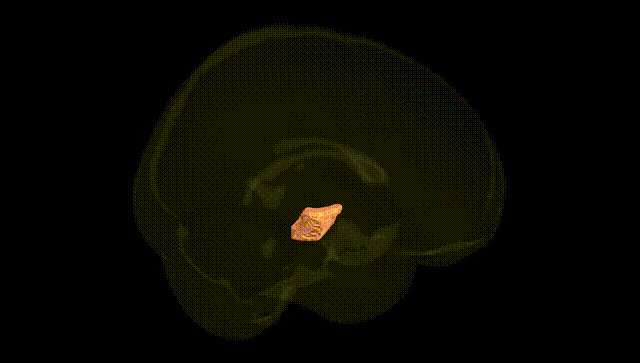 Full Brain Black