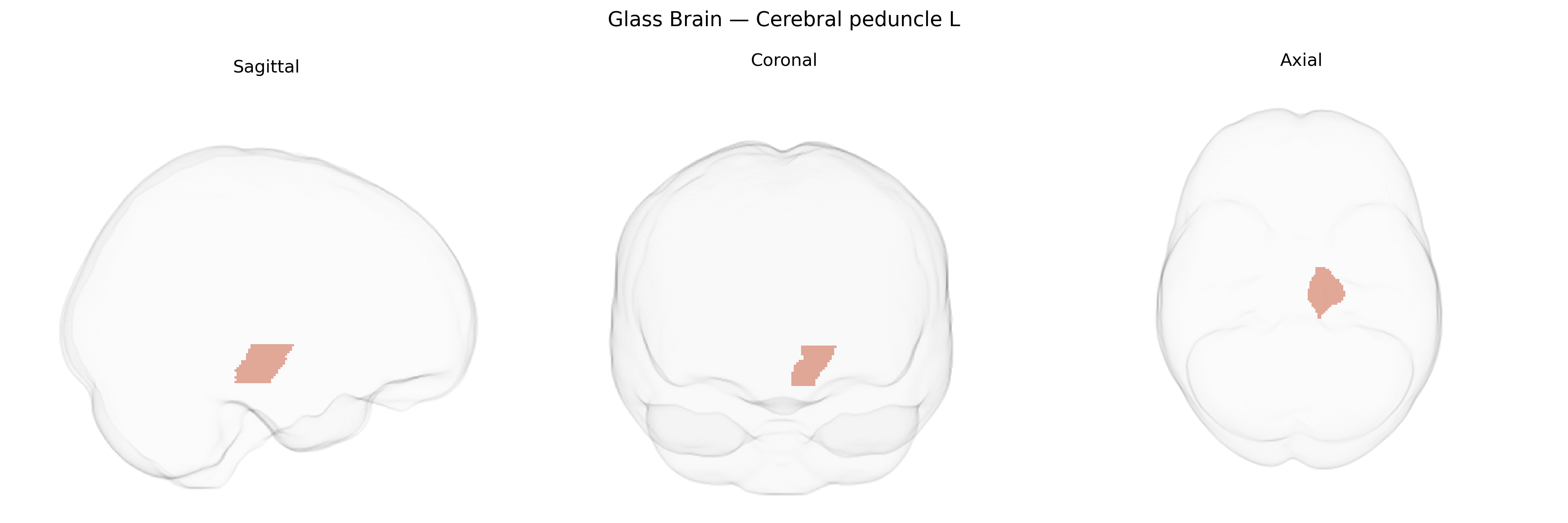 Triplanar Ghost Brain