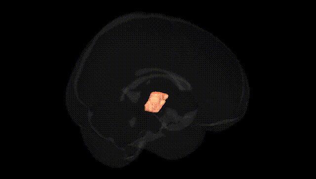 Full Brain Black
