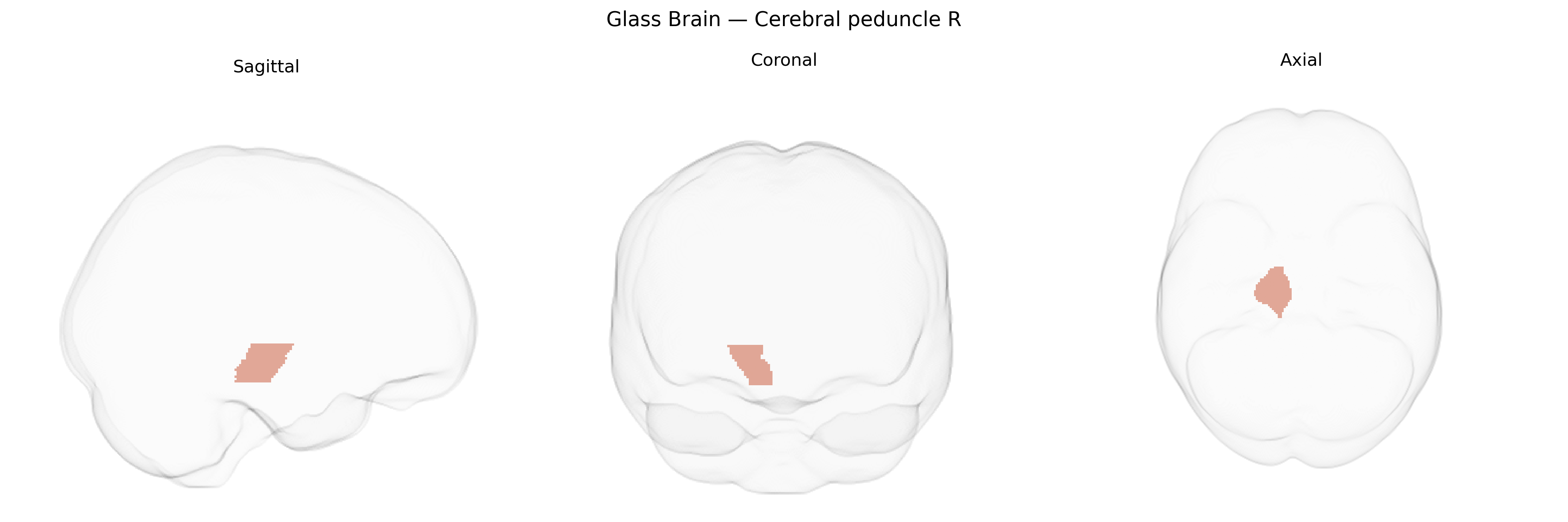 Triplanar Ghost Brain