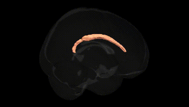 Full Brain Black