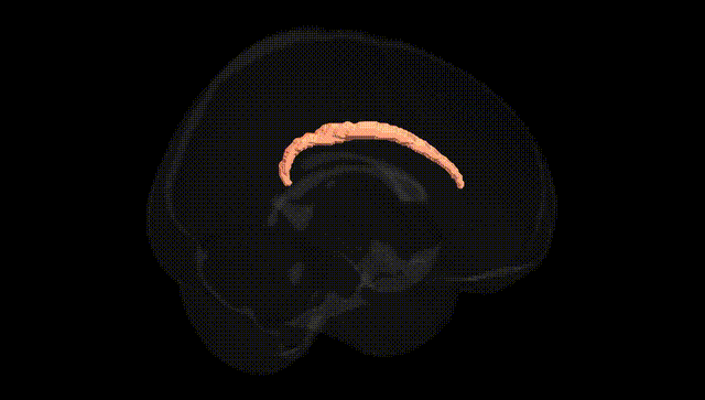 Full Brain Black