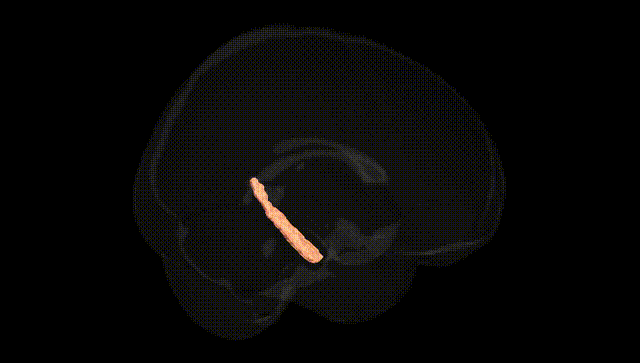 Full Brain Black