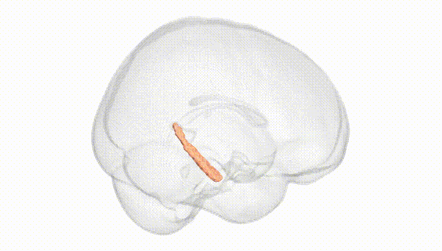 Full Brain White
