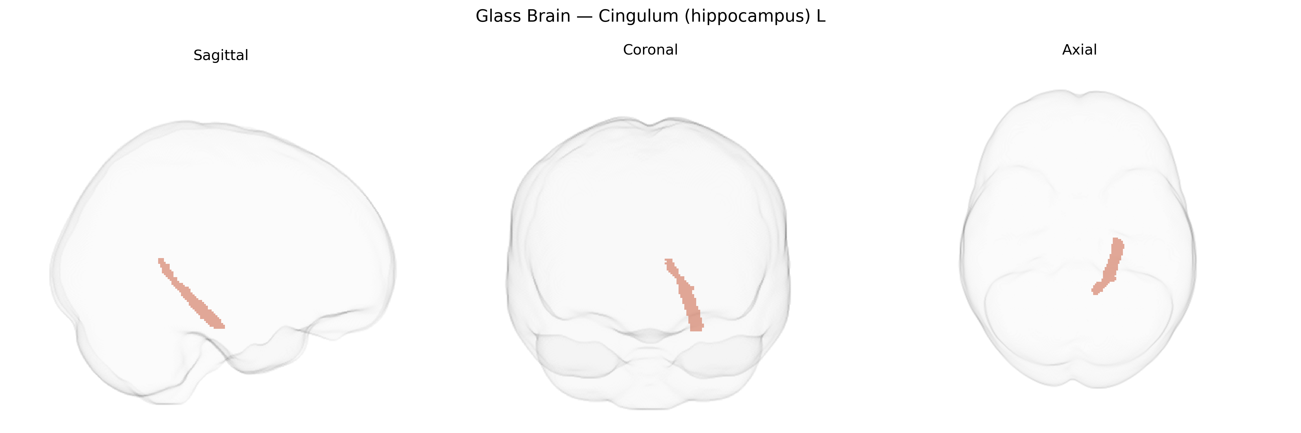 Triplanar Ghost Brain