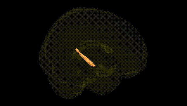 Full Brain Black