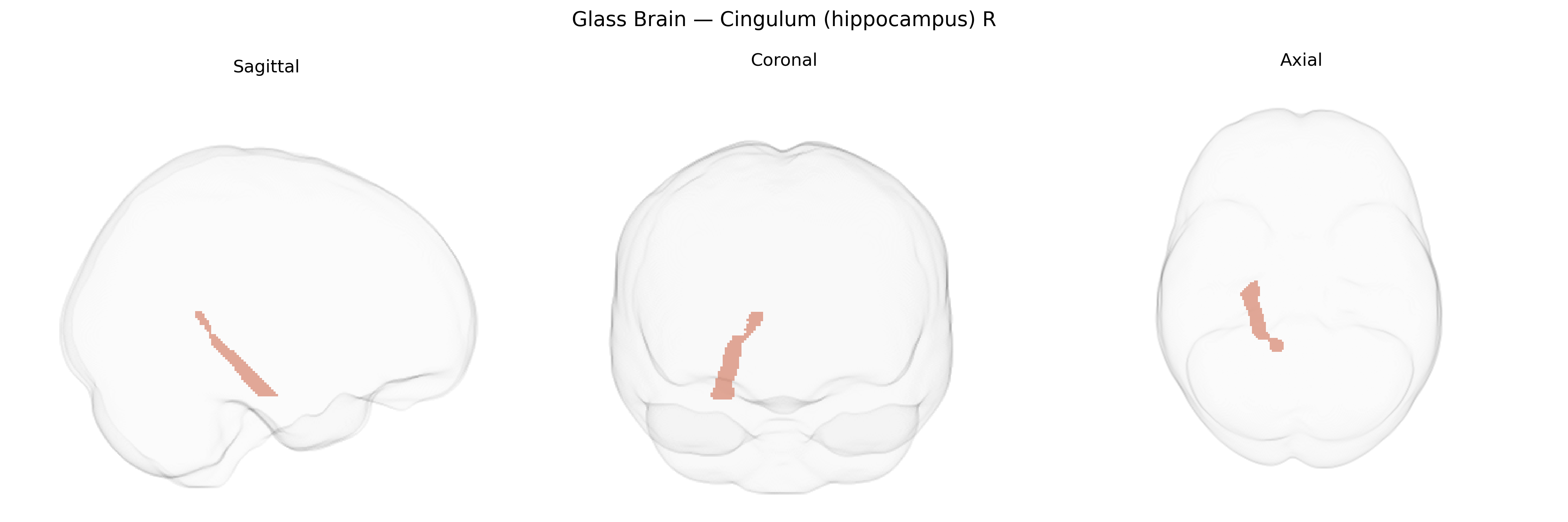 Triplanar Ghost Brain