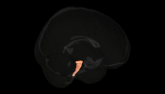 Full Brain Black